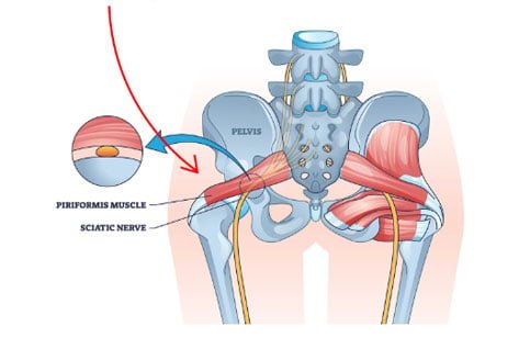 Muscle Tension Source
