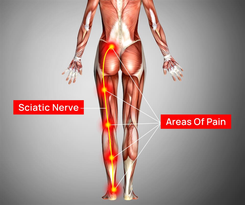 Sciatic Anatomy Diagram